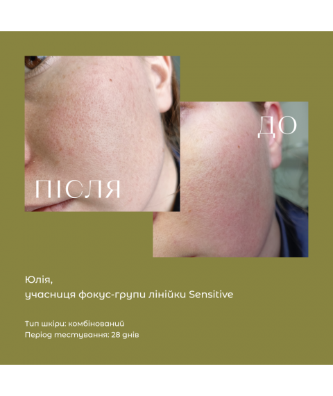 Крем для обличчя Sensitive [сенсітів] (заспокоєння, зменшення проявів куперозу) 50 мл